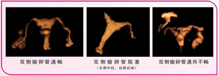 图片2.png 图片2.png