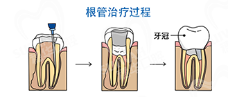 图片8.png 图片8.png
