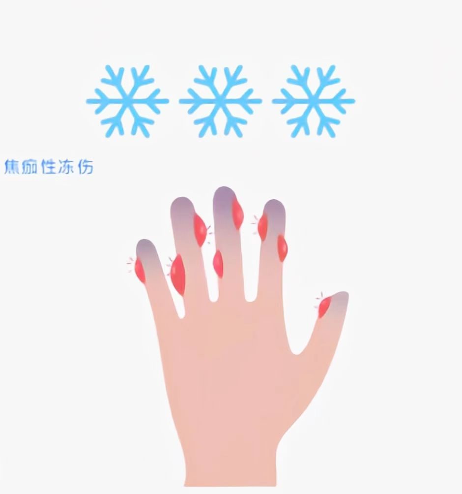 图片5.png 图片5.png